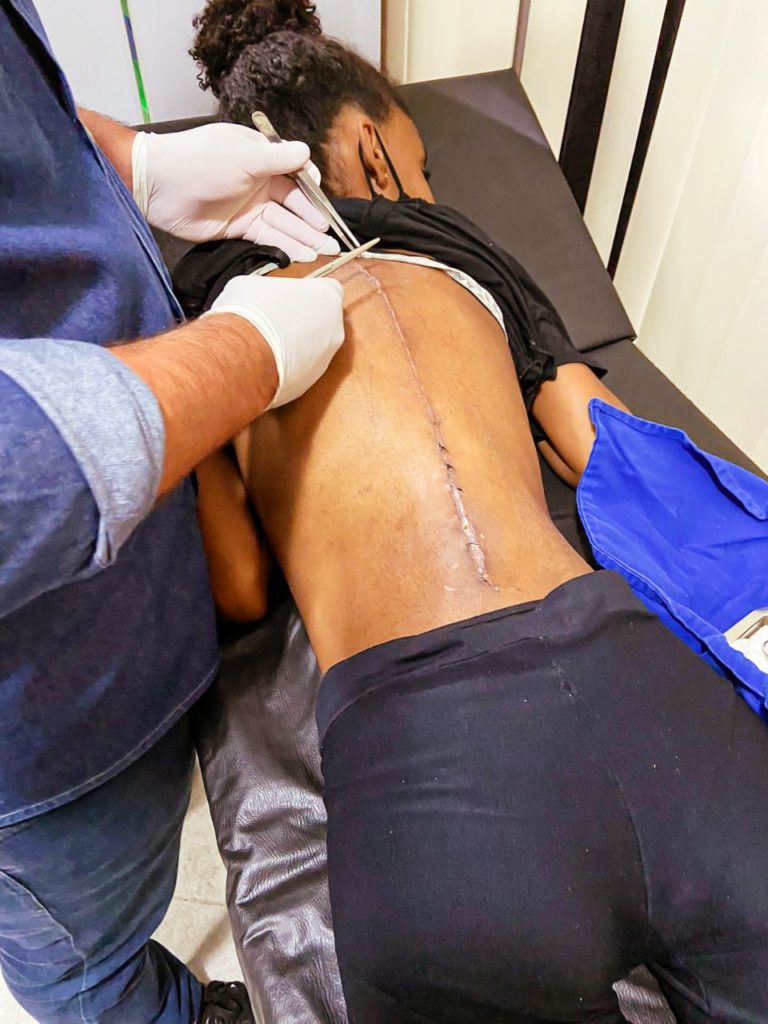Escoliose: projeto atende crianças para tratamento gratuito inédito na região 3 Projeto visa prevenir escoliose em crianças de Volta Redonda